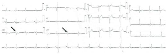 https://cdn.ncbi.nlm.nih.gov/pmc/blobs/6d2a/8742487/94e149acfb90/turkjmedsci-51-2437-fig001.jpg