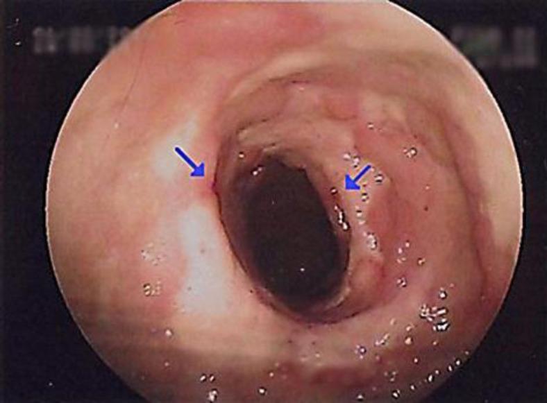 https://cdn.ncbi.nlm.nih.gov/pmc/blobs/6d2c/3551416/e5ad0d11bd73/crg-0006-0790-g01.jpg