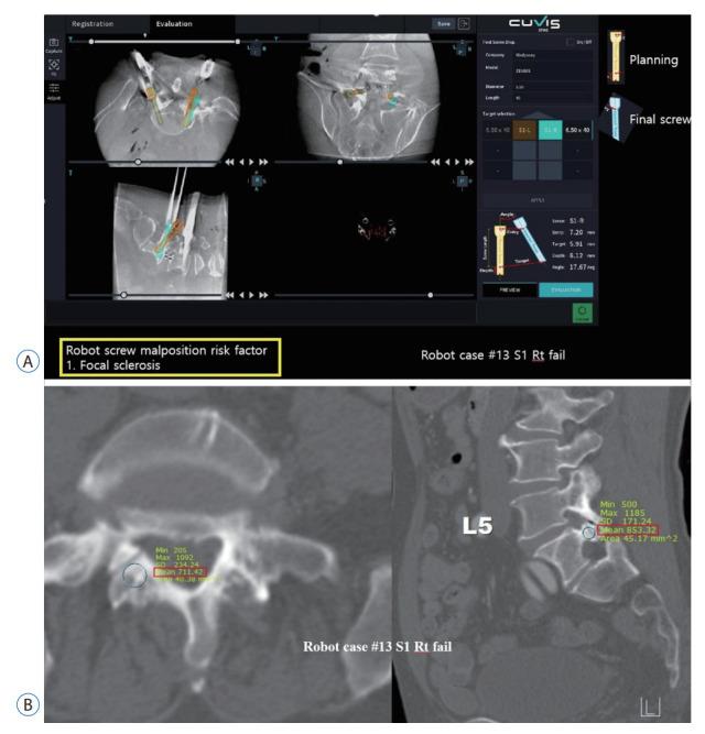 https://cdn.ncbi.nlm.nih.gov/pmc/blobs/6d33/10788558/9e46a389820c/jkns-2023-0128f8.jpg