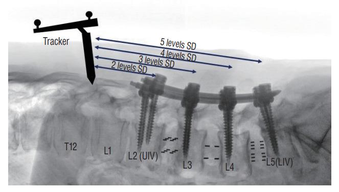 https://cdn.ncbi.nlm.nih.gov/pmc/blobs/6d33/10788558/ec00d22a3bf4/jkns-2023-0128f4.jpg