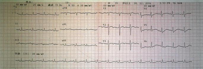 https://cdn.ncbi.nlm.nih.gov/pmc/blobs/6d33/12310503/dfd868f017b8/fonc-15-1567625-g004.jpg