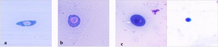 https://cdn.ncbi.nlm.nih.gov/pmc/blobs/6d37/10542352/cd8da370079b/41598_2023_43499_Fig5_HTML.jpg