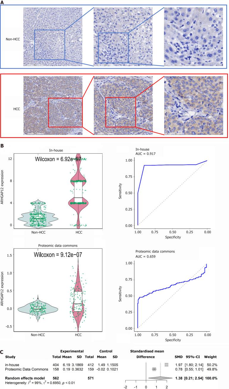 https://cdn.ncbi.nlm.nih.gov/pmc/blobs/6d3b/11514672/ca66521474ad/WJGO-16-4244-g007.jpg