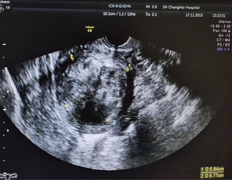 https://cdn.ncbi.nlm.nih.gov/pmc/blobs/6d3f/9803439/49db100c1990/medi-101-e32413-g001.jpg