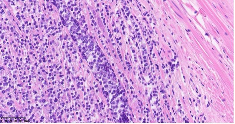 https://cdn.ncbi.nlm.nih.gov/pmc/blobs/6d42/12206796/87269f9f7360/fonc-15-1591905-g004.jpg