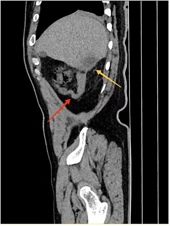 https://cdn.ncbi.nlm.nih.gov/pmc/blobs/6d42/12206796/9e18ce458d63/fonc-15-1591905-g002.jpg