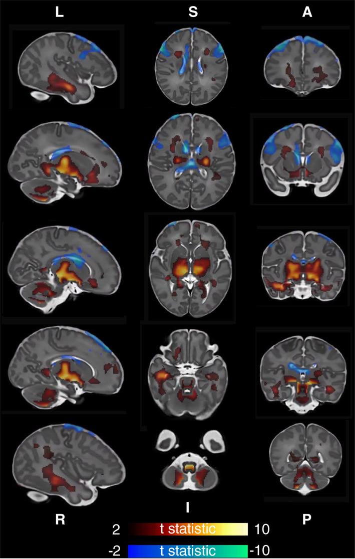 https://cdn.ncbi.nlm.nih.gov/pmc/blobs/6d46/8886657/24de60ce0a8b/HBM-43-1577-g004.jpg