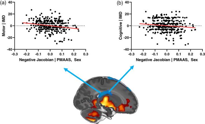 https://cdn.ncbi.nlm.nih.gov/pmc/blobs/6d46/8886657/f46100f5a8a9/HBM-43-1577-g002.jpg