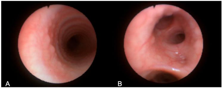 https://cdn.ncbi.nlm.nih.gov/pmc/blobs/6d4b/11989805/e78ee1e59be3/jcm-14-02320-g005.jpg