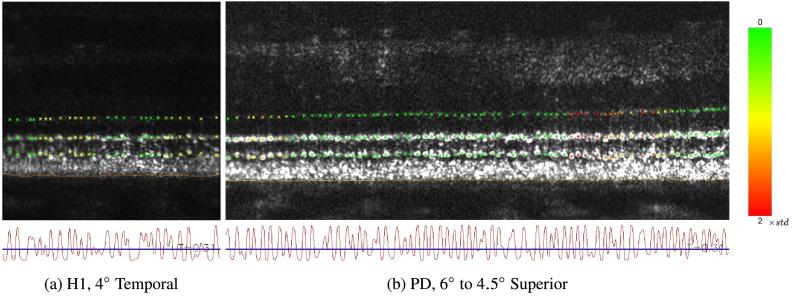 https://cdn.ncbi.nlm.nih.gov/pmc/blobs/6d4b/12339291/19bf62997a89/boe-16-8-3237-g005.jpg