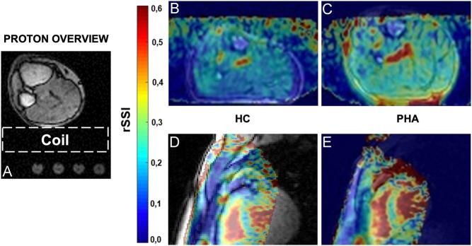https://cdn.ncbi.nlm.nih.gov/pmc/blobs/6d4d/9010811/418ea81833ec/EJE-22-0074fig2.jpg