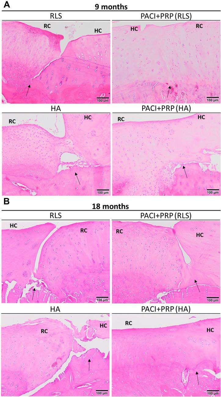 https://cdn.ncbi.nlm.nih.gov/pmc/blobs/6d4f/10275813/368052ff5581/167_2022_7295_Fig3_HTML.jpg