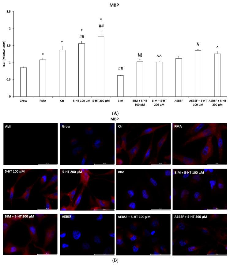 https://cdn.ncbi.nlm.nih.gov/pmc/blobs/6d4f/7962057/f09916beadb5/ijms-22-02621-g006a.jpg