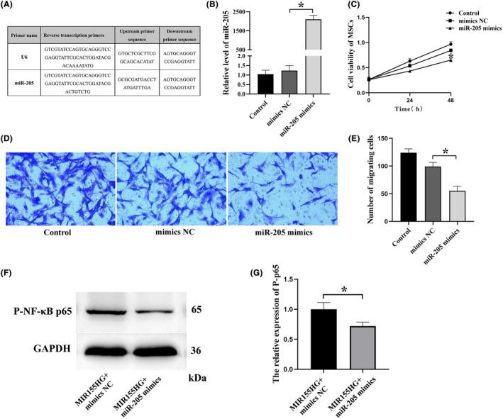 https://cdn.ncbi.nlm.nih.gov/pmc/blobs/6d54/11063722/098bb48c859e/JCMM-28-e18351-g003.jpg