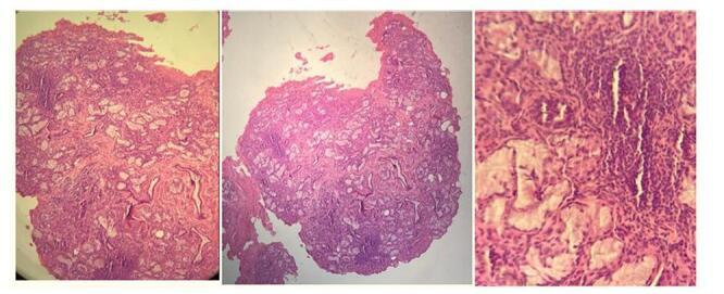 https://cdn.ncbi.nlm.nih.gov/pmc/blobs/6d55/11981398/9ca22f0b9854/ms9-87-2349-g003.jpg