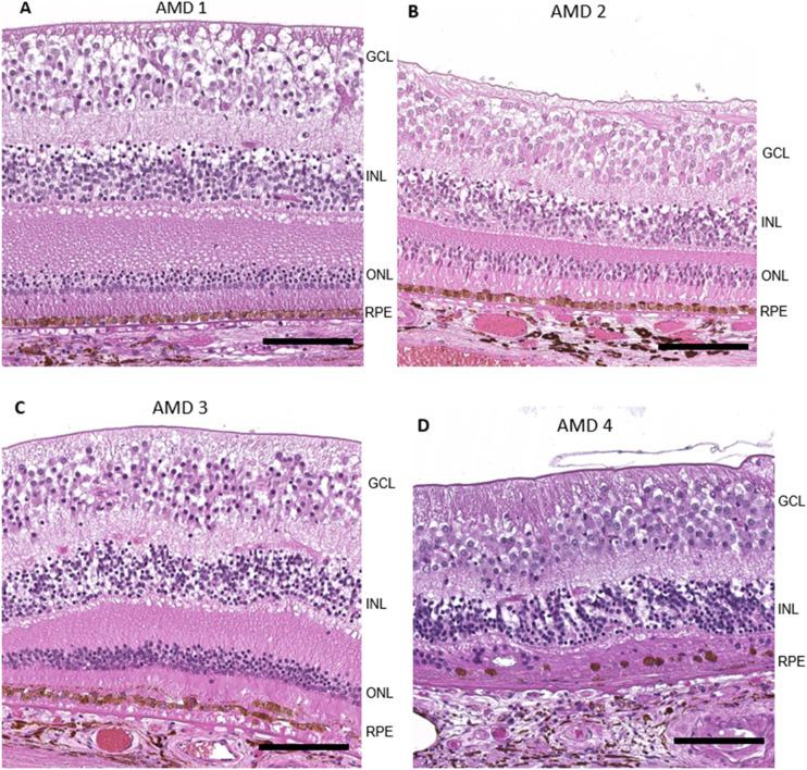 https://cdn.ncbi.nlm.nih.gov/pmc/blobs/6d55/8237111/3094219c91f1/iovs-62-7-26-f001.jpg