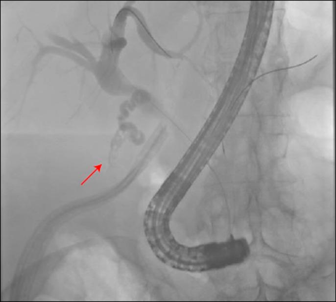https://cdn.ncbi.nlm.nih.gov/pmc/blobs/6d57/6791622/bf228239a9ec/ac9-6-e00162-g001.jpg