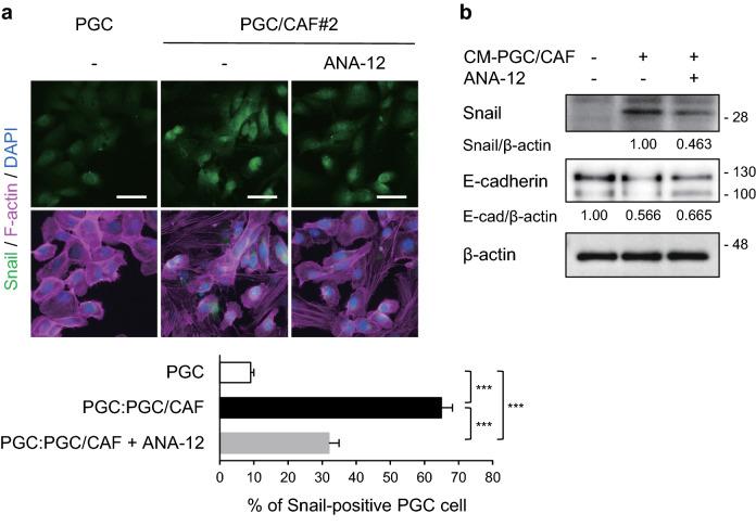 https://cdn.ncbi.nlm.nih.gov/pmc/blobs/6d5a/9584965/64dc93a2cfd7/41598_2022_22377_Fig3_HTML.jpg