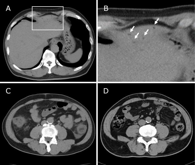 https://cdn.ncbi.nlm.nih.gov/pmc/blobs/6d5d/6928490/5c5001f8cb0b/1349-7235-58-3409-g001.jpg