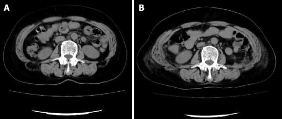 https://cdn.ncbi.nlm.nih.gov/pmc/blobs/6d62/6163131/166cb785ad09/WJCC-6-398-g001.jpg