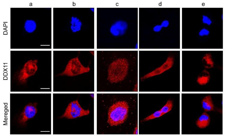 https://cdn.ncbi.nlm.nih.gov/pmc/blobs/6d65/8197413/e6661ee6231f/cancers-13-02574-g002.jpg