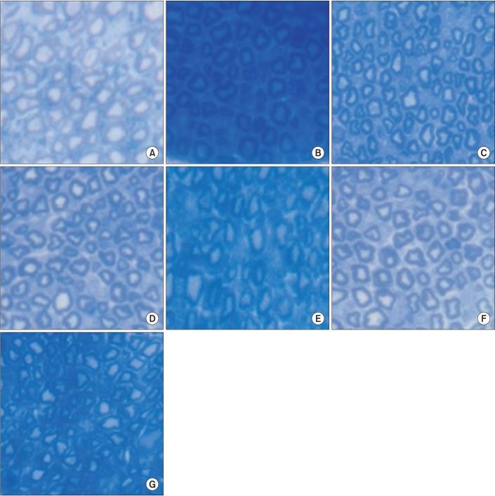 https://cdn.ncbi.nlm.nih.gov/pmc/blobs/6d6a/5532345/c344647e97c5/arm-41-402-g008.jpg