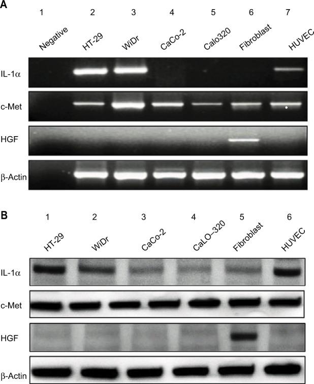 https://cdn.ncbi.nlm.nih.gov/pmc/blobs/6d6f/5640395/5bebf72855ff/cmar-9-481Fig1.jpg