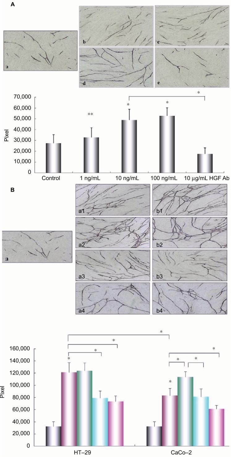 https://cdn.ncbi.nlm.nih.gov/pmc/blobs/6d6f/5640395/cba577291012/cmar-9-481Fig5.jpg