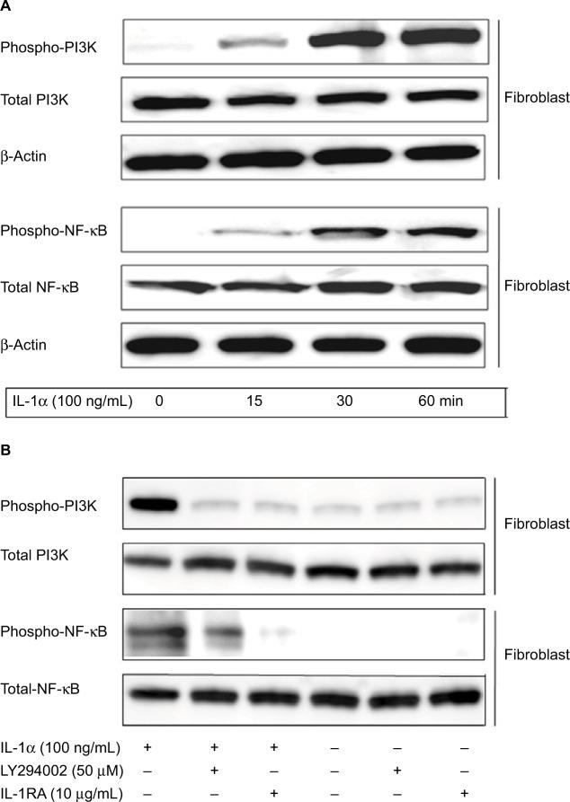 https://cdn.ncbi.nlm.nih.gov/pmc/blobs/6d6f/5640395/dade847ac139/cmar-9-481Fig6.jpg