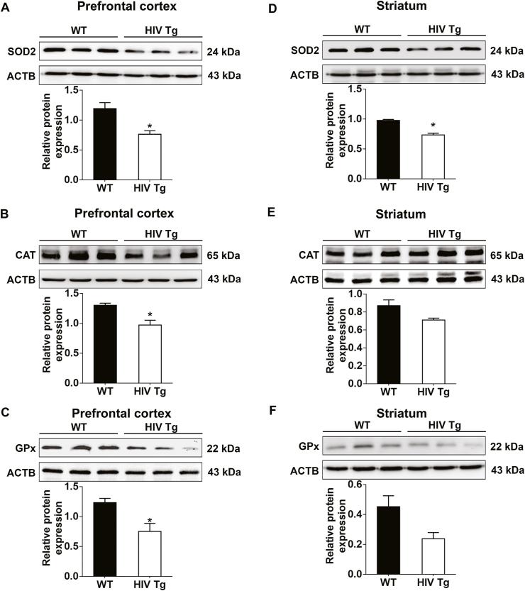 https://cdn.ncbi.nlm.nih.gov/pmc/blobs/6d71/7779826/1ab81ed88db4/gr4.jpg