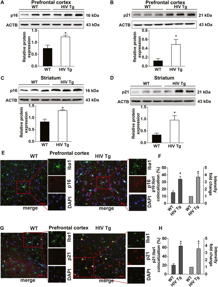 https://cdn.ncbi.nlm.nih.gov/pmc/blobs/6d71/7779826/9c27af8397c3/gr2.jpg