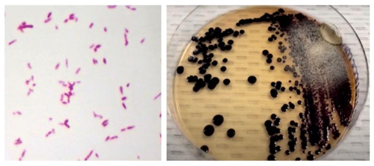 https://cdn.ncbi.nlm.nih.gov/pmc/blobs/6d72/8293149/b5d0022ec82c/idr-13-00053-g002.jpg