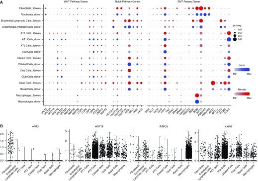 https://cdn.ncbi.nlm.nih.gov/pmc/blobs/6d79/6580683/52a0e56ab9f2/rccm.201712-2410OC_f4.jpg
