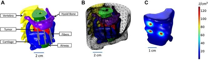 https://cdn.ncbi.nlm.nih.gov/pmc/blobs/6d7b/5396141/13bdaff317e8/LSM-47-60-g005.jpg