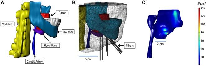 https://cdn.ncbi.nlm.nih.gov/pmc/blobs/6d7b/5396141/9a4ba24b855c/LSM-47-60-g004.jpg