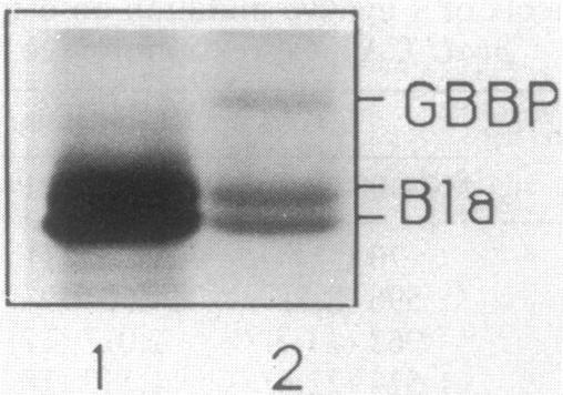 https://cdn.ncbi.nlm.nih.gov/pmc/blobs/6d7e/207083/3844d2b84fcb/jbacter00092-0476-b.jpg