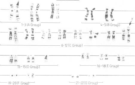 https://cdn.ncbi.nlm.nih.gov/pmc/blobs/6d94/1012665/805bdf0e1893/jmedgene00293-0013-a.jpg