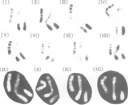 https://cdn.ncbi.nlm.nih.gov/pmc/blobs/6d94/1012665/b11f74d599bf/jmedgene00293-0015-b.jpg