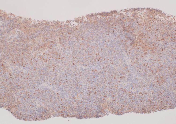 https://cdn.ncbi.nlm.nih.gov/pmc/blobs/6d96/10909682/2ca8a5427344/cureus-0016-00000053472-i03.jpg