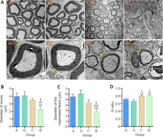 https://cdn.ncbi.nlm.nih.gov/pmc/blobs/6d98/9727441/482c7550772c/NRR-18-657-g007.jpg