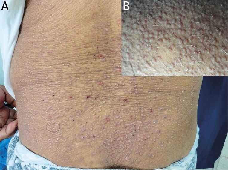 https://cdn.ncbi.nlm.nih.gov/pmc/blobs/6da0/3834705/dbe0b070b8fe/PDIA-30-21273-g001.jpg