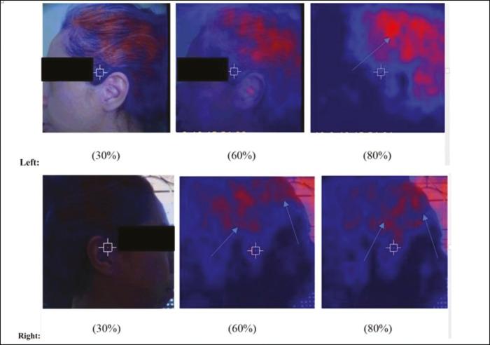 https://cdn.ncbi.nlm.nih.gov/pmc/blobs/6da5/7685285/87a688449cbe/JISPCD-10-674-g004.jpg