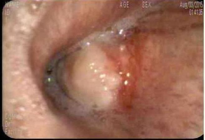 https://cdn.ncbi.nlm.nih.gov/pmc/blobs/6da9/5473730/a72784668512/cureus-0009-00000001255-i01.jpg