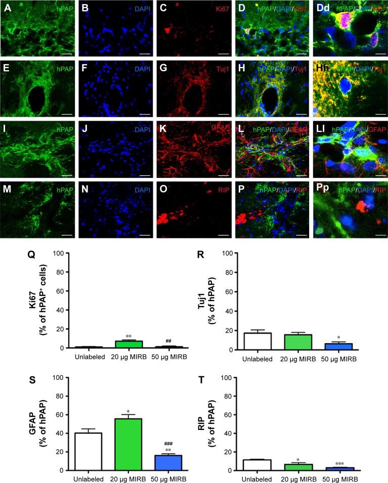 https://cdn.ncbi.nlm.nih.gov/pmc/blobs/6dae/4854246/2670f30b65e5/ijn-11-1731Fig5.jpg
