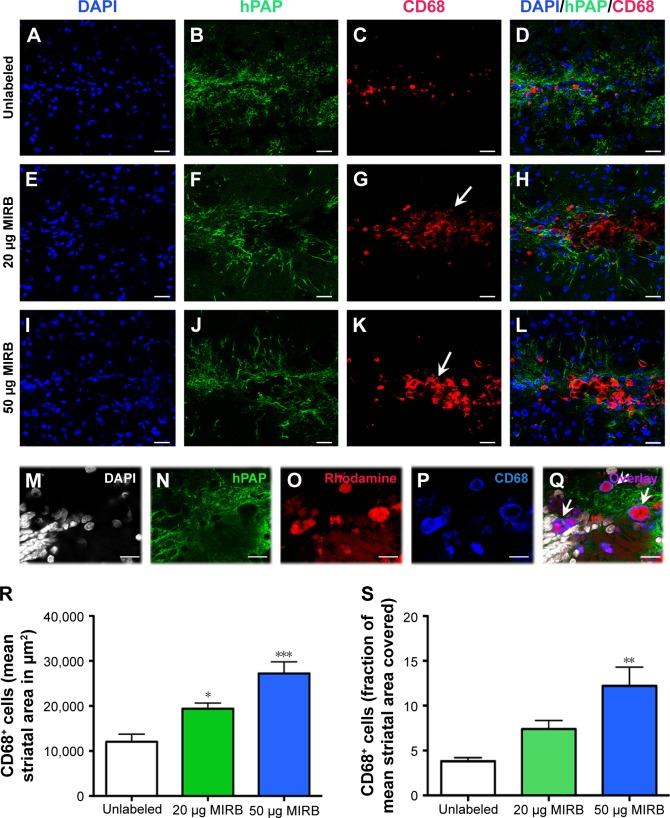 https://cdn.ncbi.nlm.nih.gov/pmc/blobs/6dae/4854246/39d807d2ff4f/ijn-11-1731Fig6.jpg