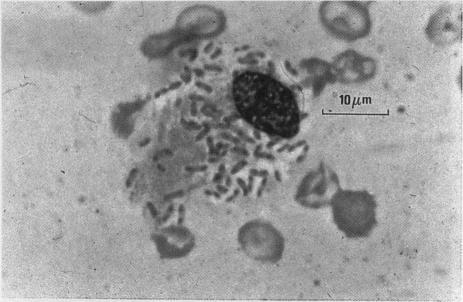 https://cdn.ncbi.nlm.nih.gov/pmc/blobs/6dbb/1194766/3ebf6f460a25/genitmed00042-0008-a.jpg