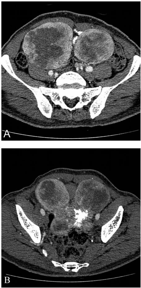 https://cdn.ncbi.nlm.nih.gov/pmc/blobs/6dbb/2779995/1c721c0caf12/ci09001401.jpg