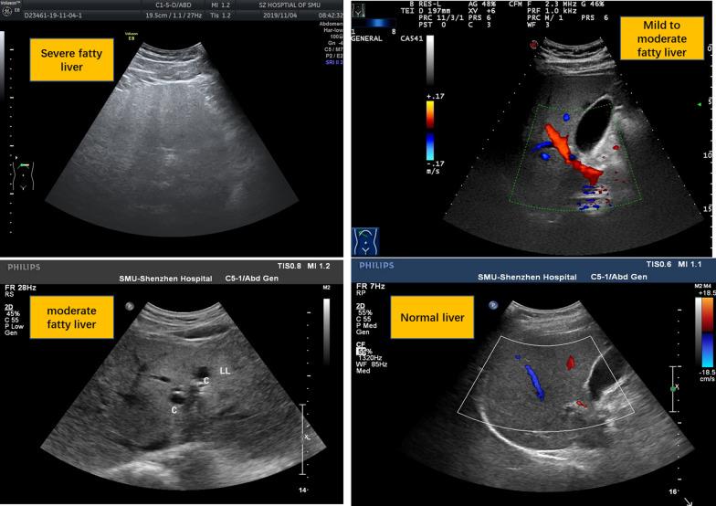 https://cdn.ncbi.nlm.nih.gov/pmc/blobs/6dc4/8276426/75bb43f799a1/13098_2021_697_Fig1_HTML.jpg