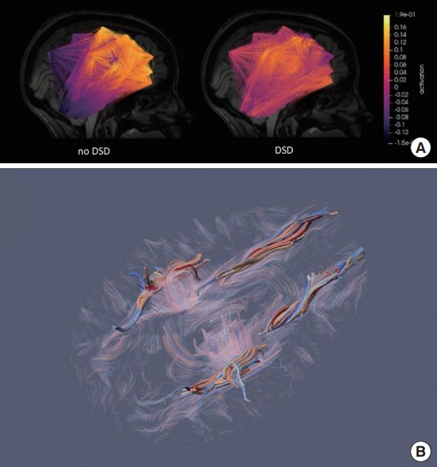 https://cdn.ncbi.nlm.nih.gov/pmc/blobs/6dcd/8896778/0eb4df91c006/inj-2142012-006f1.jpg
