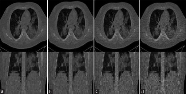 https://cdn.ncbi.nlm.nih.gov/pmc/blobs/6dcf/10336910/f9b59e76d2d8/JMSS-13-118-g019.jpg